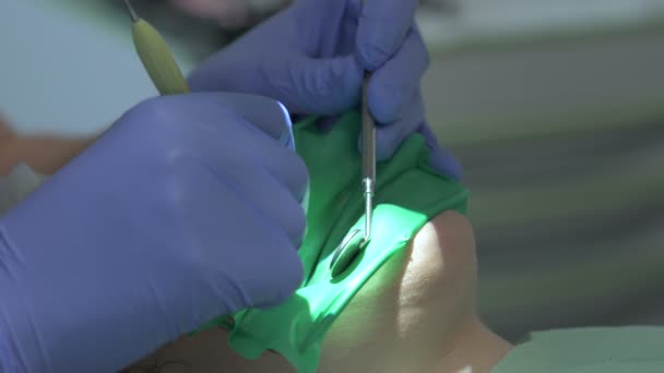 Hands Dentist Treating Patient — Stock videók