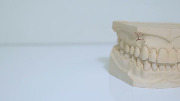 牙体概念 — 图库视频影像