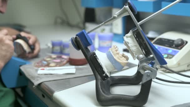 Forma Dentystyczna Ręce Technika Pracy — Wideo stockowe