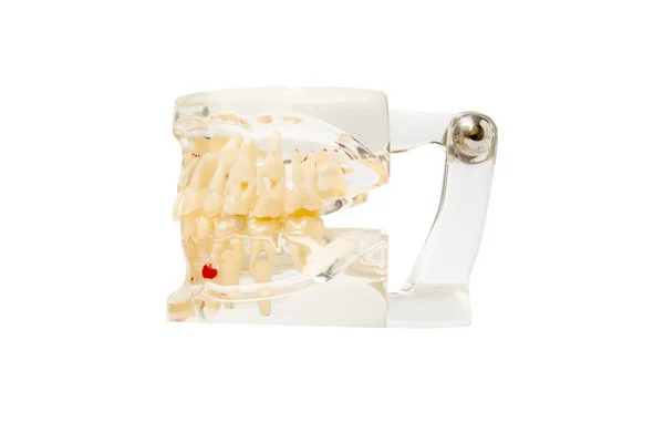 Close Instrumentos Odontológicos Conceito Check Higienista Dental Com Dentes Modelo — Fotografia de Stock