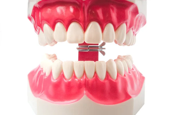 Zbliżenie Przyrządów Stomatologicznych Higienisty Stomatologicznego Koncepcji Badania Kontrolnego Modelu Zębów — Zdjęcie stockowe