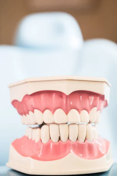 顎の歯をモデル化した歯科機器 — ストック写真