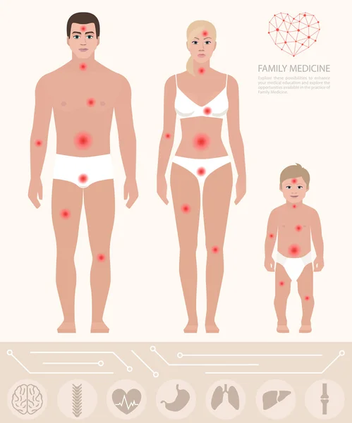 Médecine familiale, homme, femme, enfant, points de douleur, vecteur — Image vectorielle