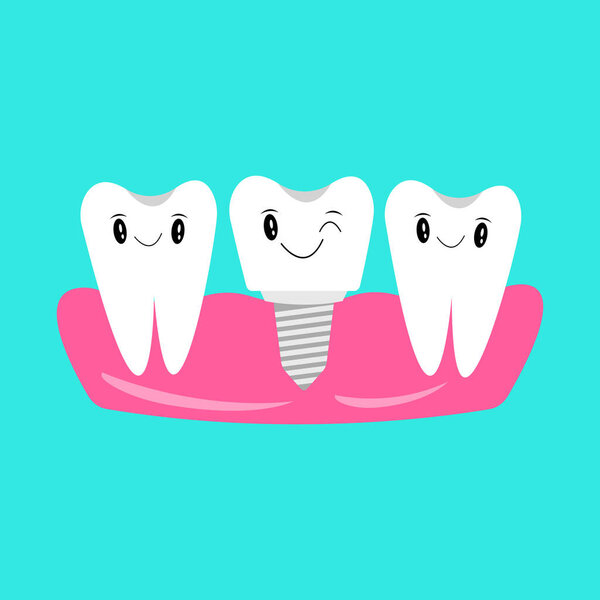 Oral dental hygiene and tooth health concept, the cartoon characters of happy dental Implant with healthy teeth on gums