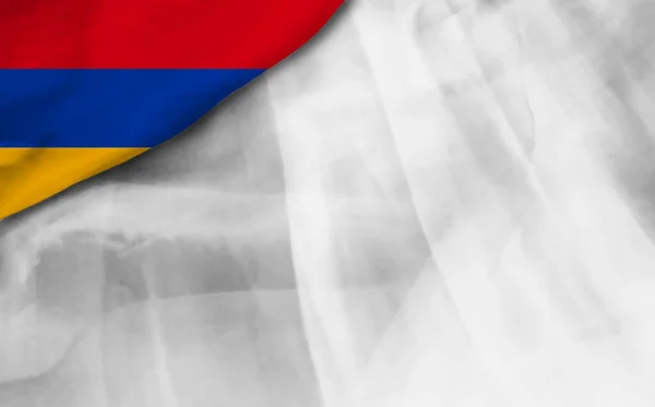 Bandera Armenia Sobre Fondo Gris Degradado — Foto de Stock