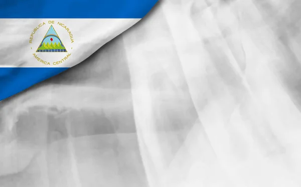 Cortina Bandeira Nicarágua Sobre Fundo Branco — Fotografia de Stock