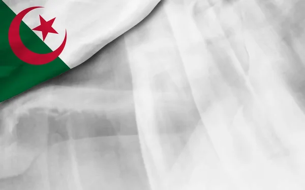 Alžírská Vlajka Šedém Pozadí Přechodu — Stock fotografie