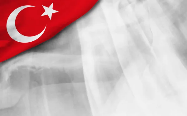 Bílé Pozadí Tureckou Vlajkou Ilustrace — Stock fotografie