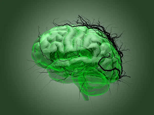 Concepto de raíz cerebral de una raíz que crece en forma de sostén humano — Foto de Stock