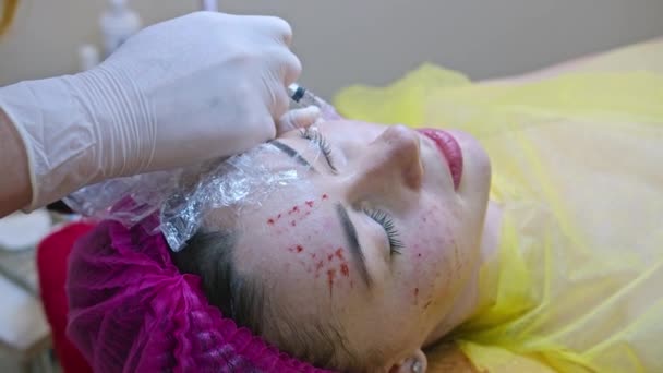 Conceito de beleza e injeção. Cosmetologia na clínica. Um esteticista experiente usando luvas brancas injeta uma injeção subcutânea com os ingredientes ativos necessários em um rosto de mulher para — Vídeo de Stock