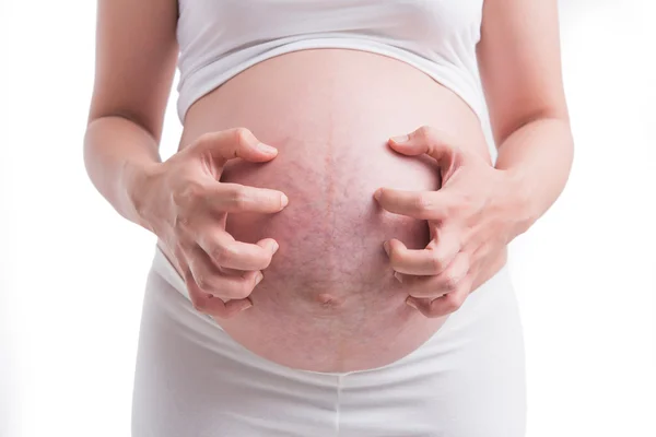 Pregnant women, stretch marks White background — Stock Photo, Image