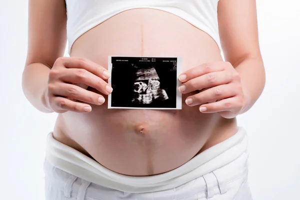 Pregnant woman holding ultrasound scan on her tummy — Stock Photo, Image