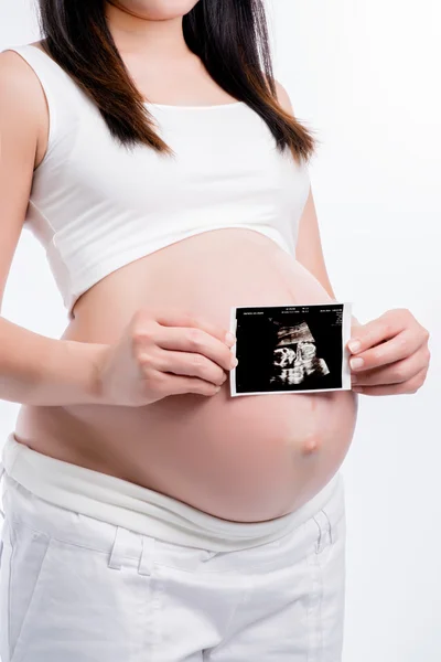 Mujer embarazada sosteniendo ecografía en su barriga — Foto de Stock