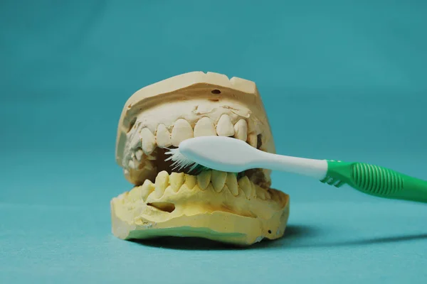 Odlew Zębów Szczoteczki Zębów Jasnoniebieskim Tle — Zdjęcie stockowe