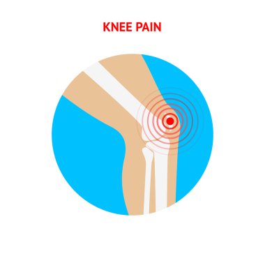 Knee pain. Knee pain icon isolated on white background. clipart