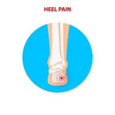 Topuk ağrısı. İnsan ayak bileği eklem simgesi arka görünümü. Vektör çizimi