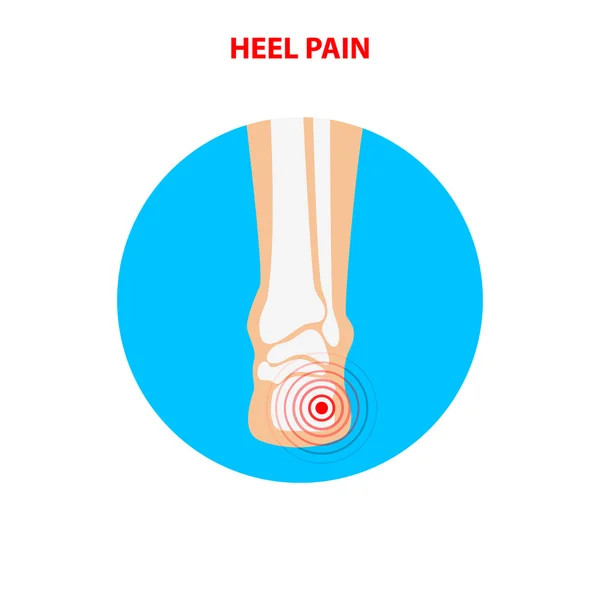 Bolest na podpatku. Ikona zpětného kloubu lidského kotníku. Vektorová ilustrace — Stockový vektor