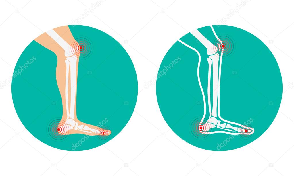 Pain in knee pain, heel Stock Vector by