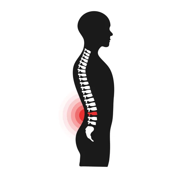 Concepto Dolor Espalda Problema Salud Columna Humana Círculo Dolor Ilustración — Archivo Imágenes Vectoriales