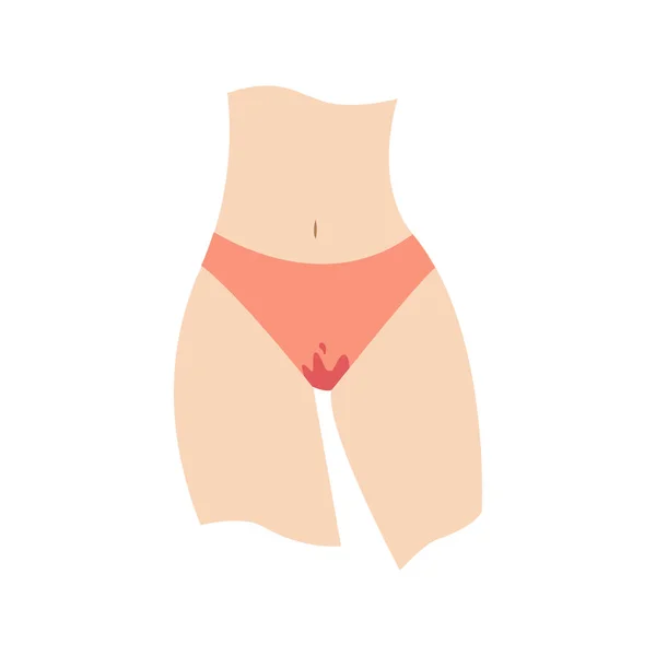 穿着沾满血迹的内裤的女人的尸体 经期抽筋 女性卫生观念 关键日子 经前综合症 内裤之类的话题 — 图库矢量图片