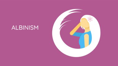 Beyaz Saçlı Soluk Düz Albino Cilt Kadın Çizgi Film Karakteri Çizim Vektörü Tasarım Albinizm Hastalığı