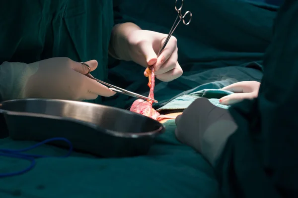 맹 장 수술 — 스톡 사진