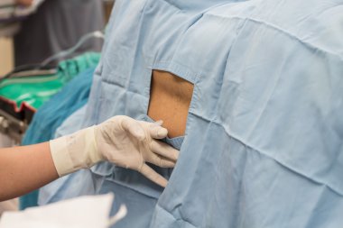 spinal block
