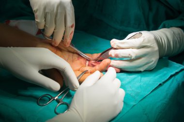 Doktor cerrahi el hastası. 