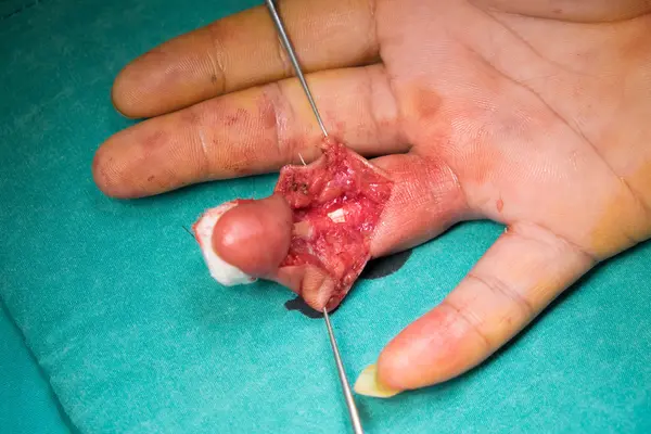 the doctor surgery patient hand