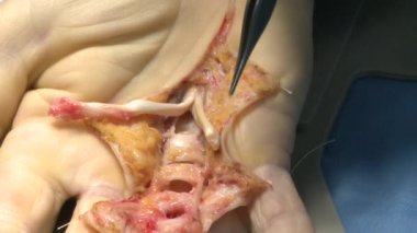 cerrahi ameliyathane