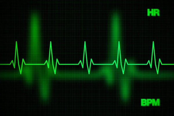 Καρδιακή συχνότητα γράφημα φόντου — Φωτογραφία Αρχείου