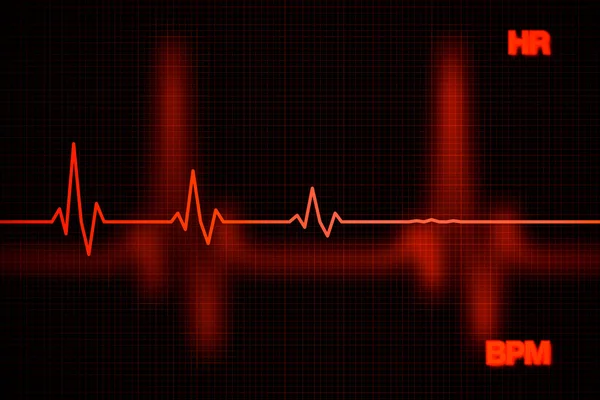 Αποτυχία καρδιακή συχνότητα γράφημα φόντου — Φωτογραφία Αρχείου
