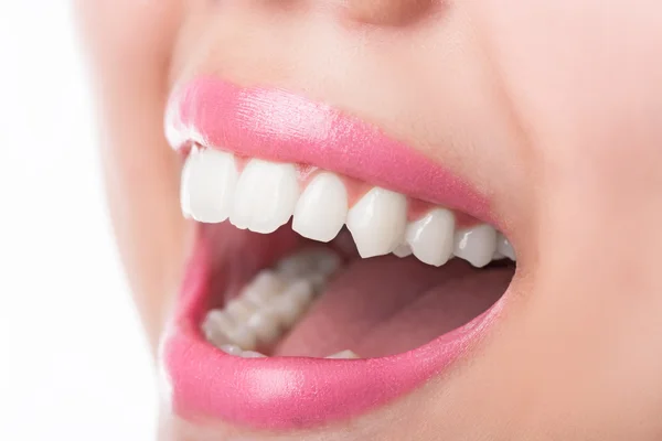 Nahaufnahme junge Frau lächelt weißen Glamour Zähne. — Stockfoto