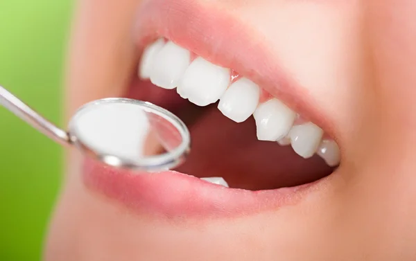 Close up young woman smiling white glamour teeth. — Stock Photo, Image