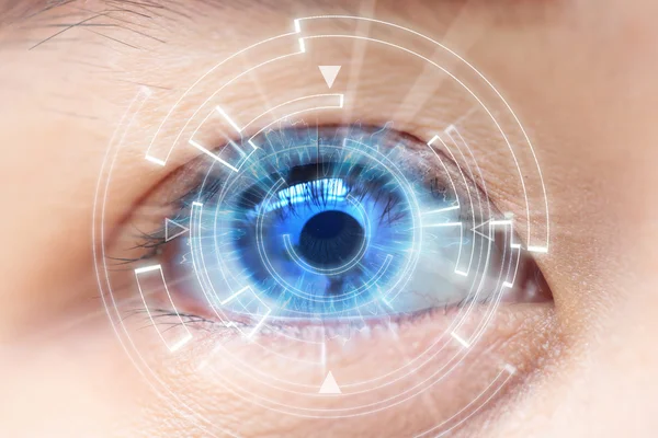 Γκρο πλαν του μπλε μάτι της γυναίκας. Υψηλές τεχνολογίες στην το φουτουριστικό. καταρράκτη στα μάτια — Φωτογραφία Αρχείου