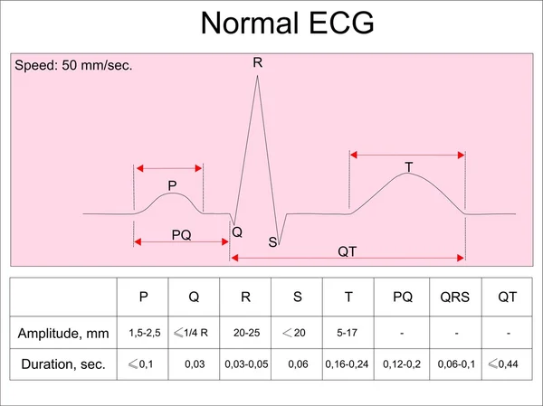 ECG humano normal — Vector de stock