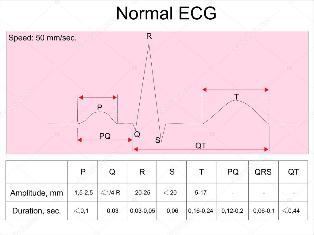 Vector Diagram Ecg Images - How To Guide And Refrence