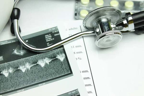 Stetoskop dan hasil dari echocardiography — Stok Foto