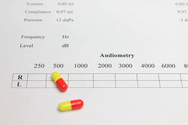 Az eredmények tympanogram — Stock Fotó