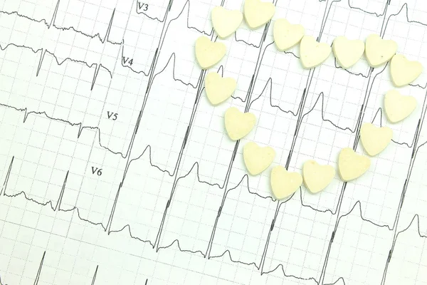 Resultaten av EKG — Stockfoto