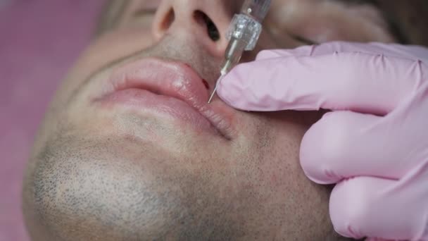 Hombre recibiendo inyección de belleza para los labios. Primer plano de las manos del cosmetólogo haciendo la inyección en los labios masculinos. Aumento de labios — Vídeo de stock