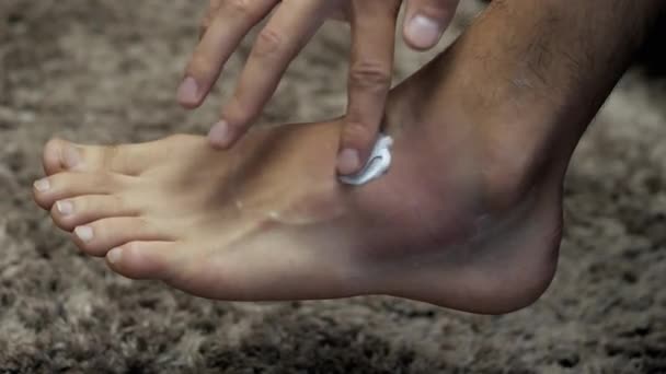 Close-up dari tangan mans mengoleskan memar pada kaki, keseleo dan memar pada kaki, konsep rehabilitasi — Stok Video