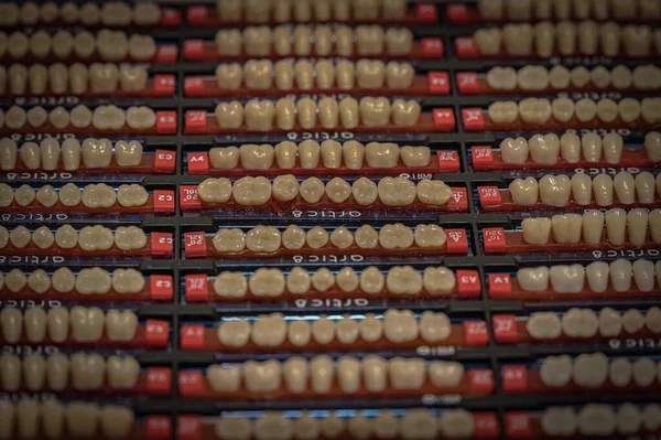 Muestras Dientes Artificiales Humanos Para Técnico Dental Para Crear Reemplazo —  Fotos de Stock