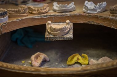 Bir diş teknisyeniyle dişleri dökülen ya da çekilen bir kişinin dişlerinin bir kopyası.