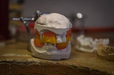 Bir diş teknisyeniyle dişleri dökülen ya da çekilen bir kişinin dişlerinin bir kopyası.