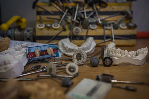 석고에 사람의 의사의 주위에 치아를 만드는 도구들이 — 스톡 사진