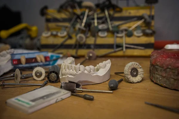 Una Copia Diente Humano Fundido Yeso Encuentra Mesa Dentista Rodeado —  Fotos de Stock