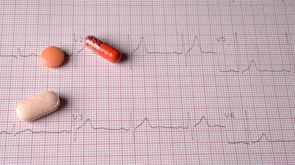 Ekokardiyograf test raporunu kapat (EKG) Anormal kalp ritmini ilaçla birlikte göster.