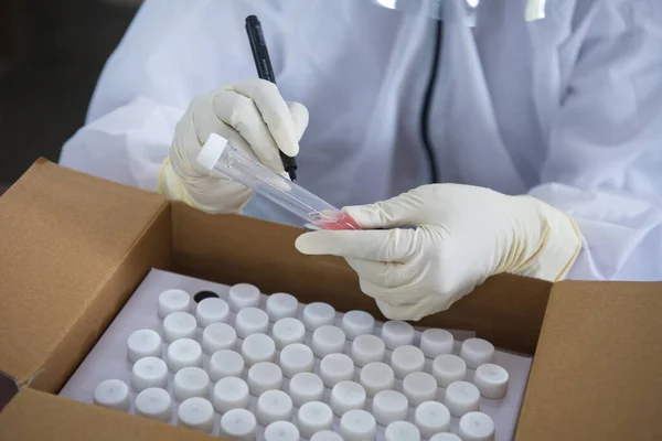 MUMBAI / INDIA-APRIL 21, 2020: Sağlık çalışanı Coronavirus 'un yayılmasına karşı önleyici bir önlem olarak Kurla' da COVID-19 Coronavirus test sürüşü sırasında viral taşıma sistemi numune tüpü hakkında yazı yazdı.