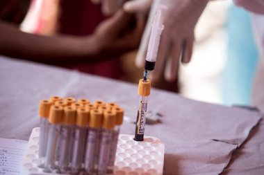 MUMBAI / INDIA - 30 Mayıs 2020: Bir tıp çalışanı, COVID-19 Coronavirus için ulusal sero araştırması sırasında Dharavi 'de kan örneği topluyor